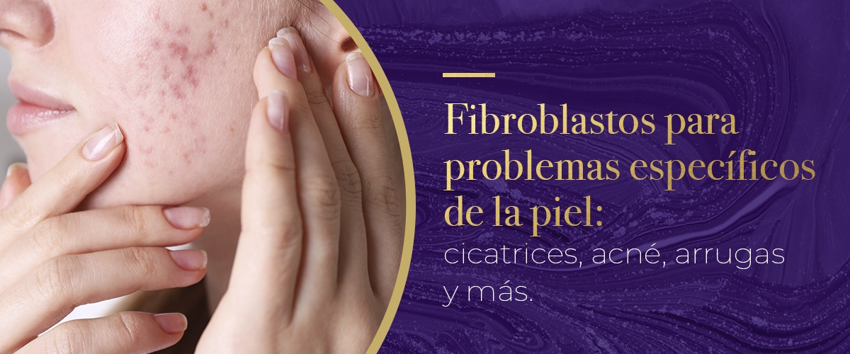 Fibroblastos para problemas específicos de la piel: cicatrices, acné, arrugas y más